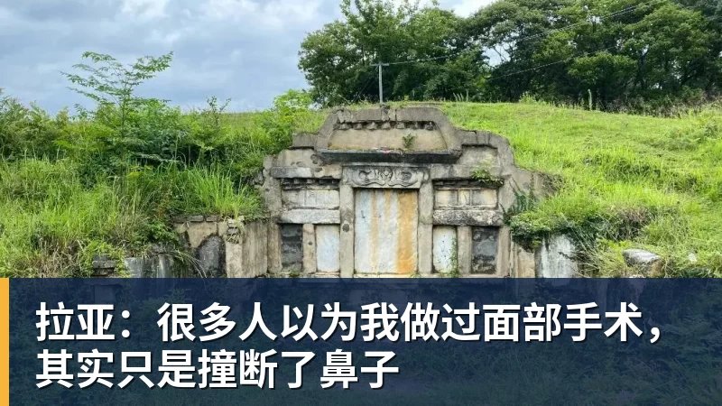 拉亚：很多人以为我做过面部手术，其实只是撞断了鼻子